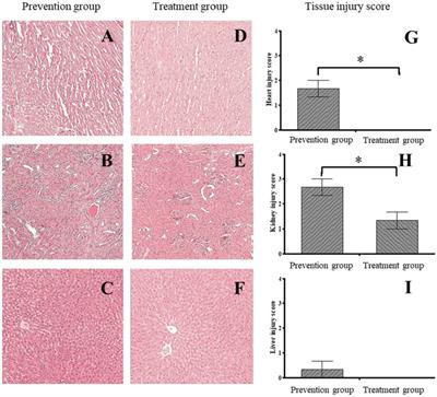 L-Glutamine is better for treatment than prevention in exhaustive exercise